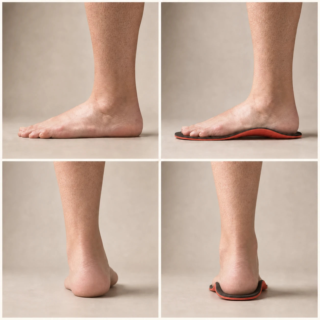 Side and rear views of the same foot without and with the structured Ortavio ArcCore insole
